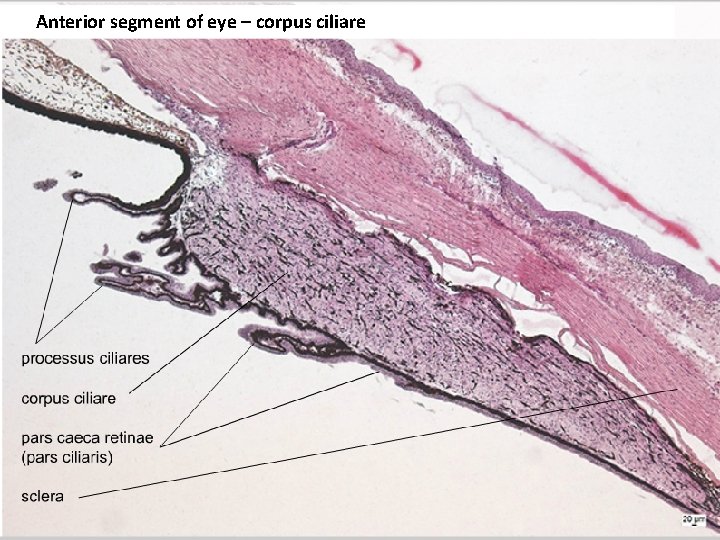  Anterior segment of eye – corpus ciliare 
