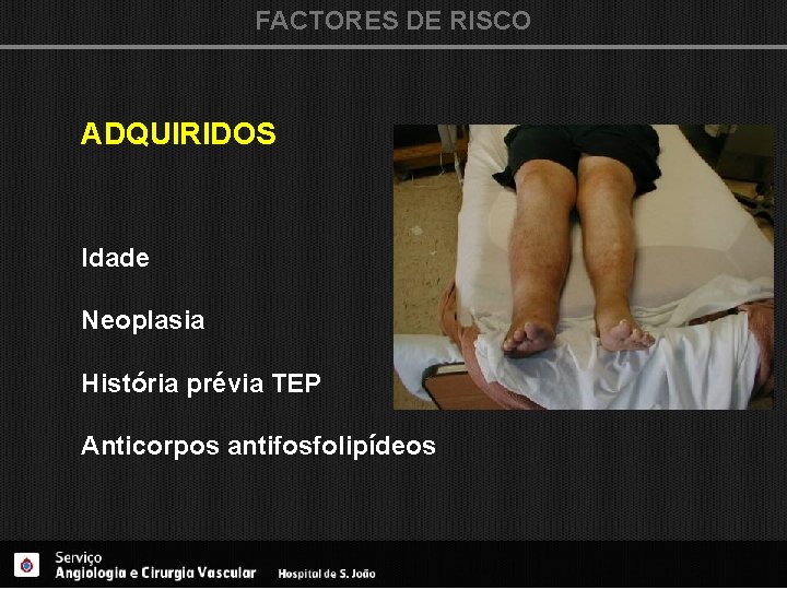FACTORES DE RISCO ADQUIRIDOS Idade Neoplasia História prévia TEP Anticorpos antifosfolipídeos 