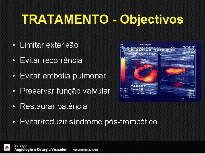 TRATAMENTO - Objectivos • Limitar extensão • Evitar recorrência • Evitar embolia pulmonar •