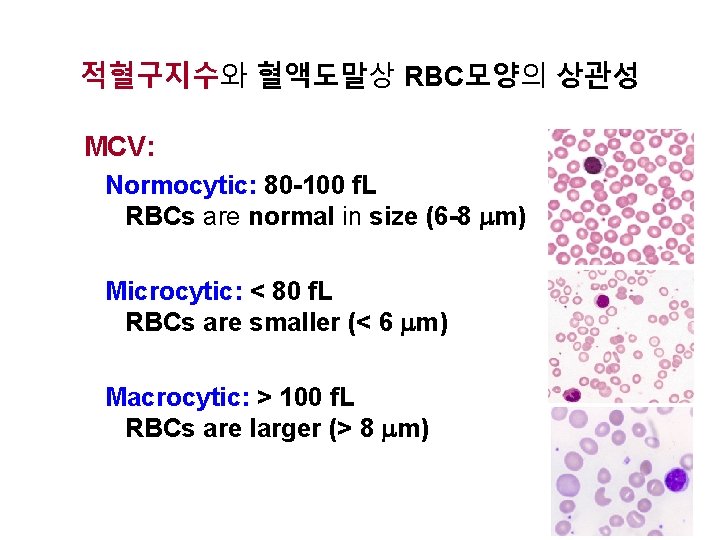 적혈구지수와 혈액도말상 RBC모양의 상관성 MCV: Normocytic: 80 -100 f. L RBCs are normal in