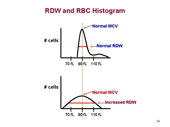 RDW and RBC Histogram Normal MCV # cells Normal RDW 70 f. L 90