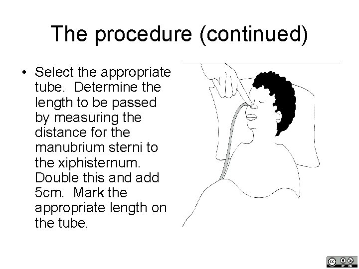 The procedure (continued) • Select the appropriate tube. Determine the length to be passed