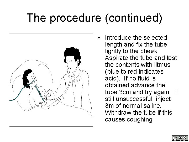 The procedure (continued) • Introduce the selected length and fix the tube lightly to