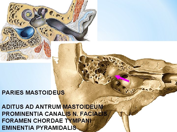 PARIES MASTOIDEUS ADITUS AD ANTRUM MASTOIDEUM PROMINENTIA CANALIS N. FACIALIS FORAMEN CHORDAE TYMPANI EMINENTIA