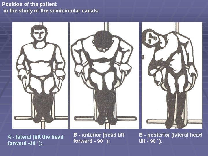 Position of the patient in the study of the semicircular canals: A - lateral