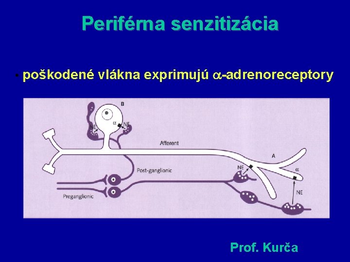 Periférna senzitizácia • poškodené vlákna exprimujú -adrenoreceptory Prof. Kurča 