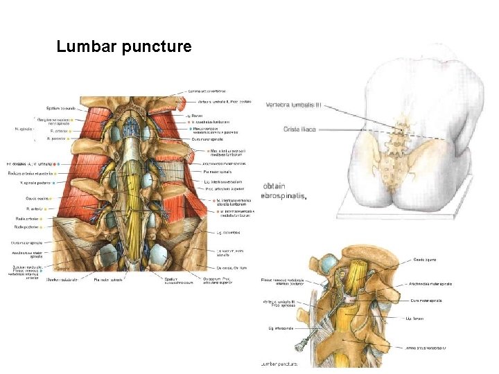 Lumbar puncture 