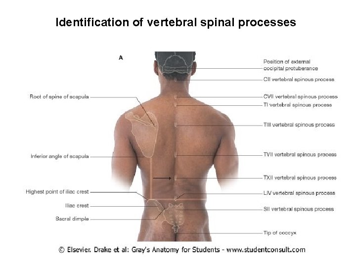 Identification of vertebral spinal processes 
