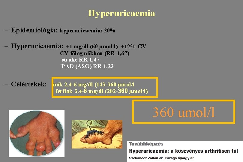 Hyperuricaemia – Epidemiológia: hyperuricaemia: 20% – Hyperuricaemia: +1 mg/dl (60 µmol/l) +12% CV CV