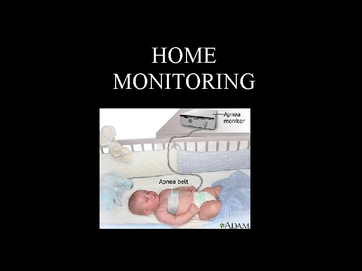 HOME MONITORING 
