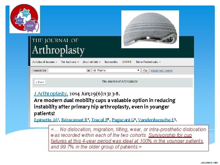 J Arthroplasty. 2014 Jun; 29(6): 1323 -8. Are modern dual mobility cups a valuable