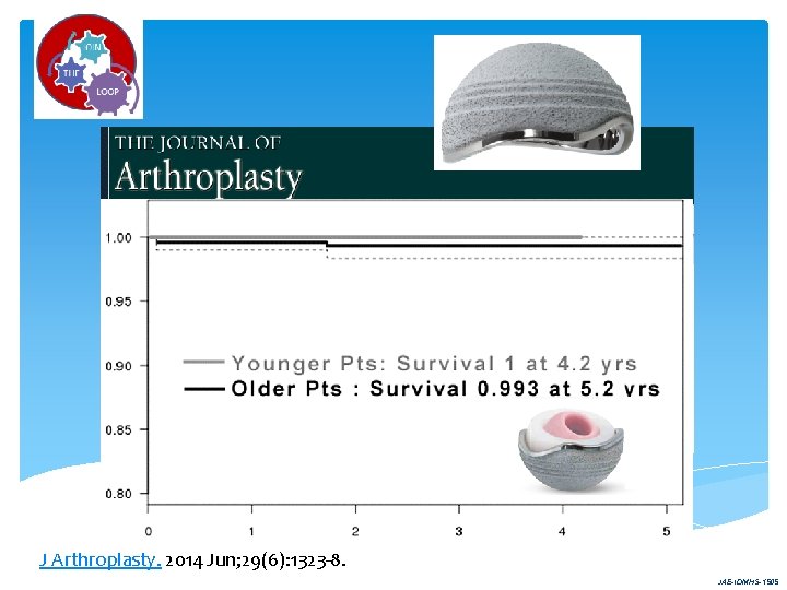 J Arthroplasty. 2014 Jun; 29(6): 1323 -8. Are modern dual mobility cups a valuable