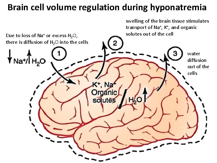 Brain cell volume regulation during hyponatremia Due to loss of Na+ or excess H