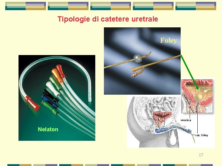 Tipologie di catetere uretrale Foley Nelaton 17 