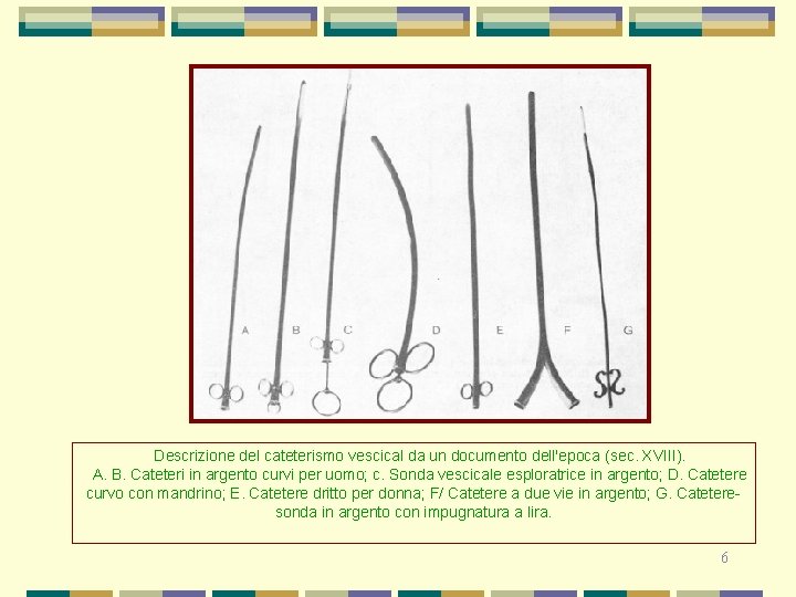  Descrizione del cateterismo vescical da un documento dell'epoca (sec. XVIII). A. B. Cateteri