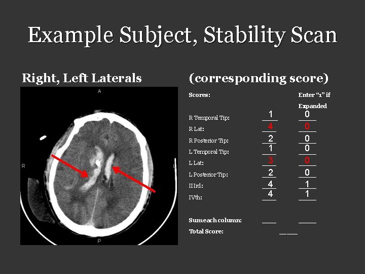 Example Subject, Stability Scan Right, Left Laterals (corresponding score) Scores: Enter “ 1” if