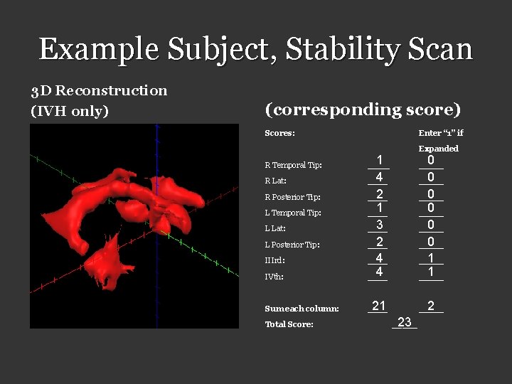 Example Subject, Stability Scan 3 D Reconstruction (IVH only) (corresponding score) Scores: Enter “