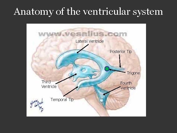 Anatomy of the ventricular system Lateral Ventricle Posterior Tip Trigone Third Ventricle Temporal Tip