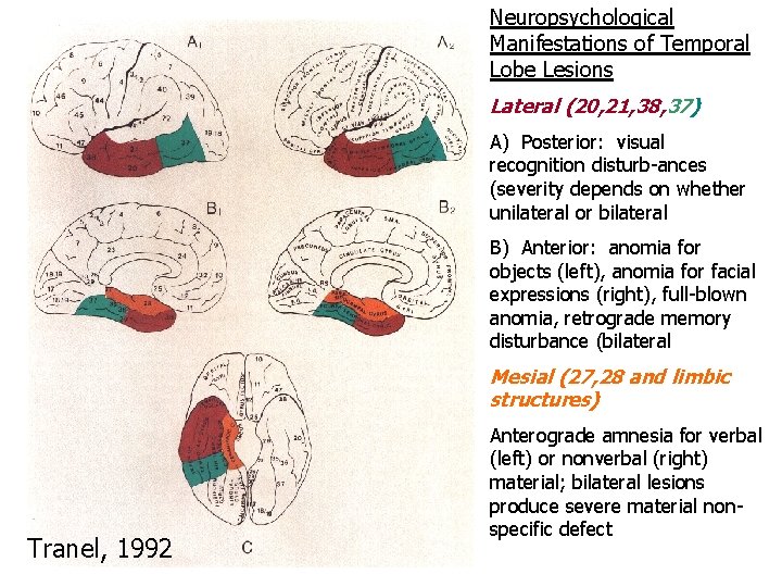 Neuropsychological Manifestations of Temporal Lobe Lesions Lateral (20, 21, 38, 37) A) Posterior: visual