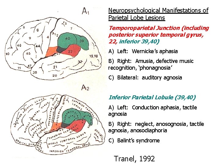 Neuropsychological Manifestations of Parietal Lobe Lesions Temporoparietal Junction (including posterior superior temporal gyrus, 22,