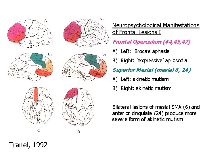 Neuropsychological Manifestations of Frontal Lesions I Frontal Operculum (44, 45, 47) A) Left: Broca’s