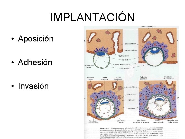 IMPLANTACIÓN • Aposición • Adhesión • Invasión 