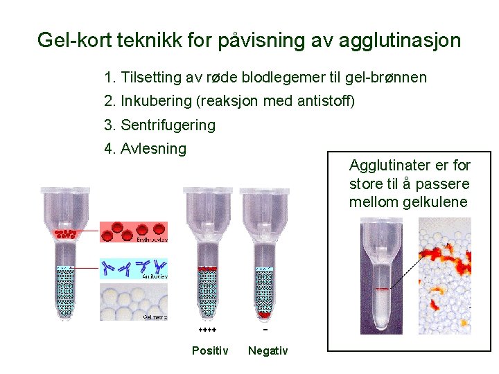 Gel-kort teknikk for påvisning av agglutinasjon 1. Tilsetting av røde blodlegemer til gel-brønnen 2.
