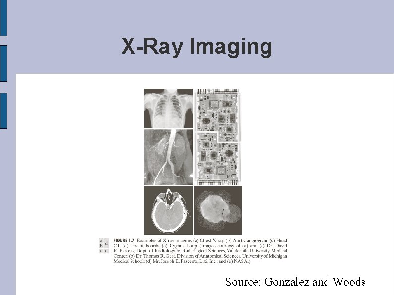 X-Ray Imaging Source: Gonzalez and Woods 