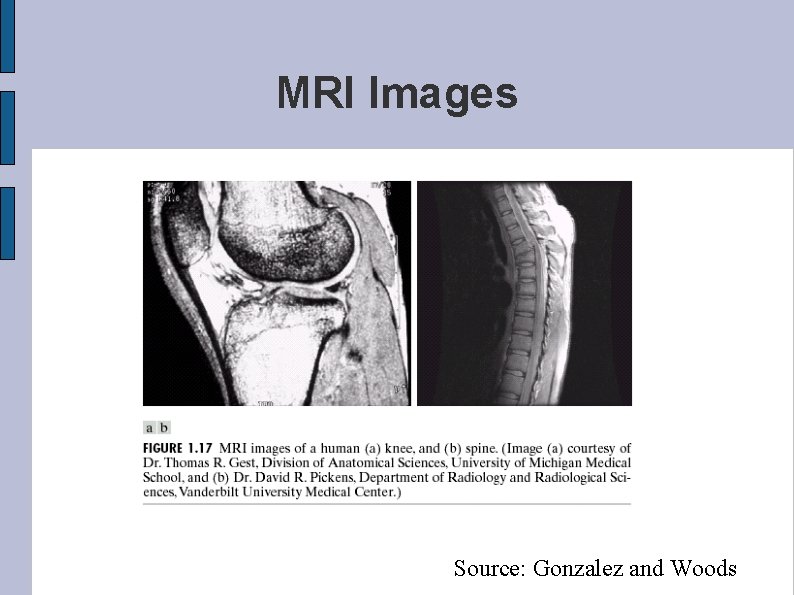 MRI Images Source: Gonzalez and Woods 