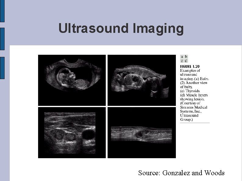 Ultrasound Imaging Source: Gonzalez and Woods 