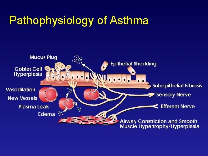 Pathophysiology of Asthma 