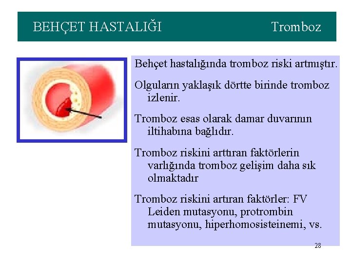 BEHÇET HASTALIĞI Tromboz Behçet hastalığında tromboz riski artmıştır. Olguların yaklaşık dörtte birinde tromboz izlenir.