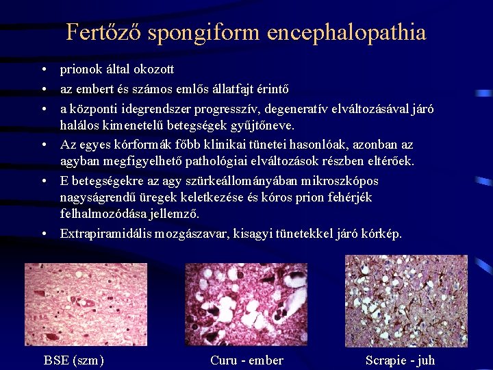 Fertőző spongiform encephalopathia • prionok által okozott • az embert és számos emlős állatfajt