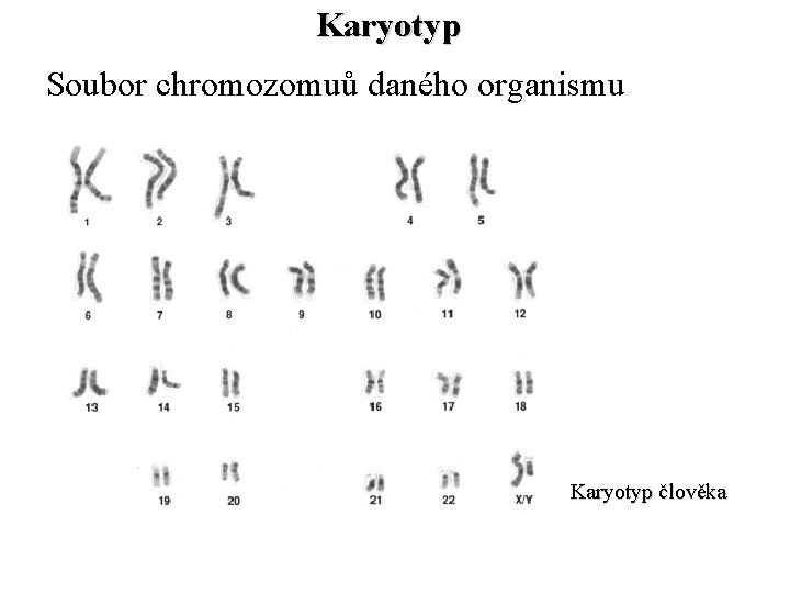 Karyotyp Soubor chromozomuů daného organismu Karyotyp člověka 