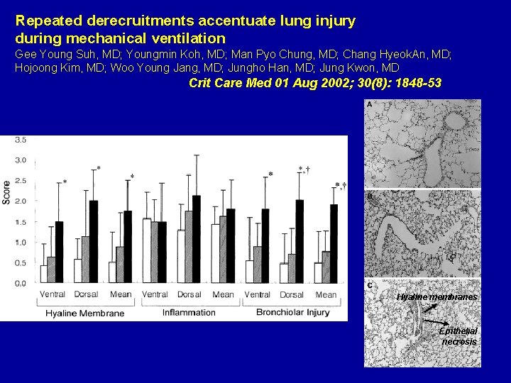 Repeated derecruitments accentuate lung injury during mechanical ventilation Gee Young Suh, MD; Youngmin Koh,