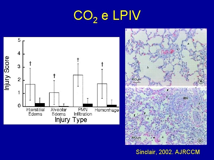 CO 2 e LPIV Sinclair, 2002. AJRCCM 