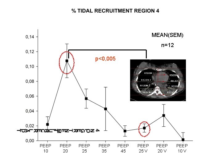 MEAN(SEM) n=12 p<0, 005 PEEP 10 PEEP 25 PEEP 35 PEEP 45 PEEP 25