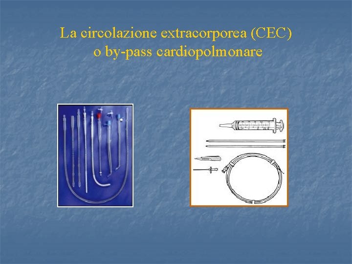 La circolazione extracorporea (CEC) o by-pass cardiopolmonare 