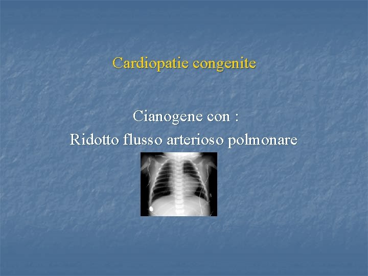 Cardiopatie congenite Cianogene con : Ridotto flusso arterioso polmonare 