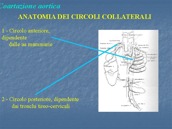 Coartazione aortica ANATOMIA DEI CIRCOLI COLLATERALI 1 - Circolo anteriore, dipendente dalle aa mammarie