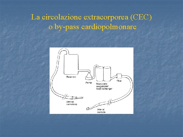 La circolazione extracorporea (CEC) o by-pass cardiopolmonare 