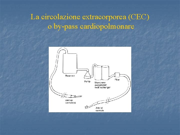 La Circolazione Extracorporea CEC Prof Roberto Gaeta Chirurgia