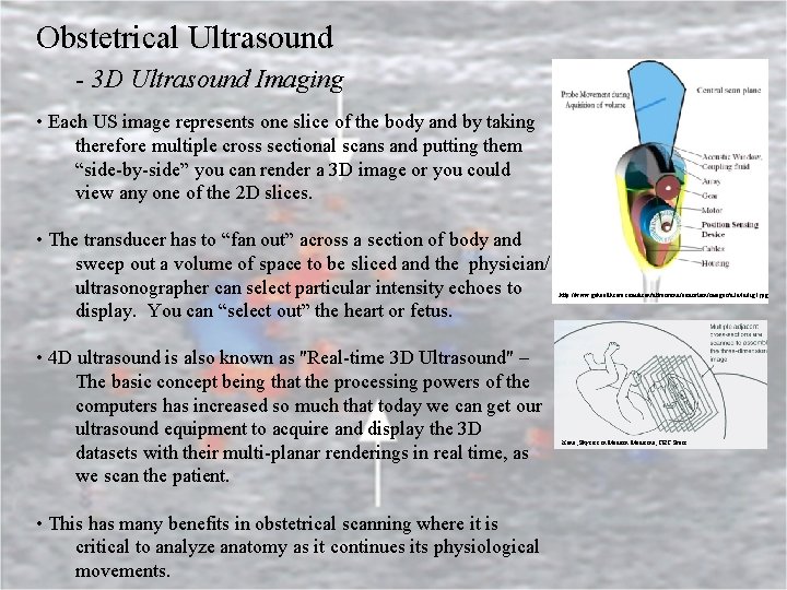 Obstetrical Ultrasound - 3 D Ultrasound Imaging • Each US image represents one slice