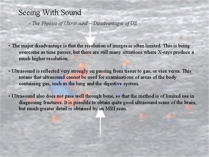 Seeing With Sound - The Physics of Ultrasound – Disadvantages of US • The