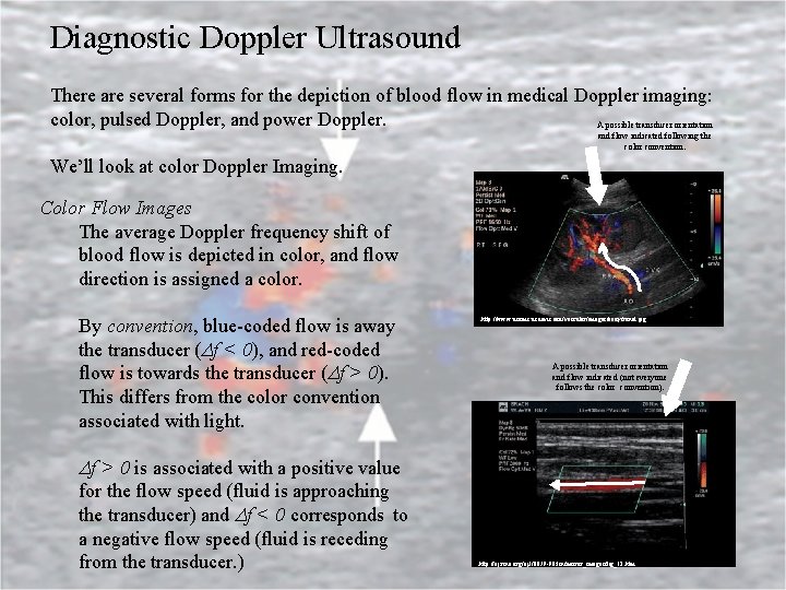 Diagnostic Doppler Ultrasound There are several forms for the depiction of blood flow in