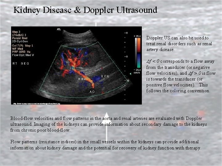 Kidney Disease & Doppler Ultrasound Doppler US can also be used to treat renal