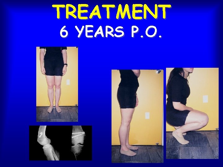 TREATMENT 6 YEARS P. O. 