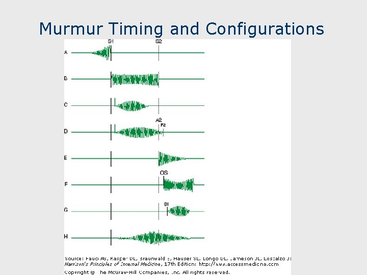 Murmur Timing and Configurations 