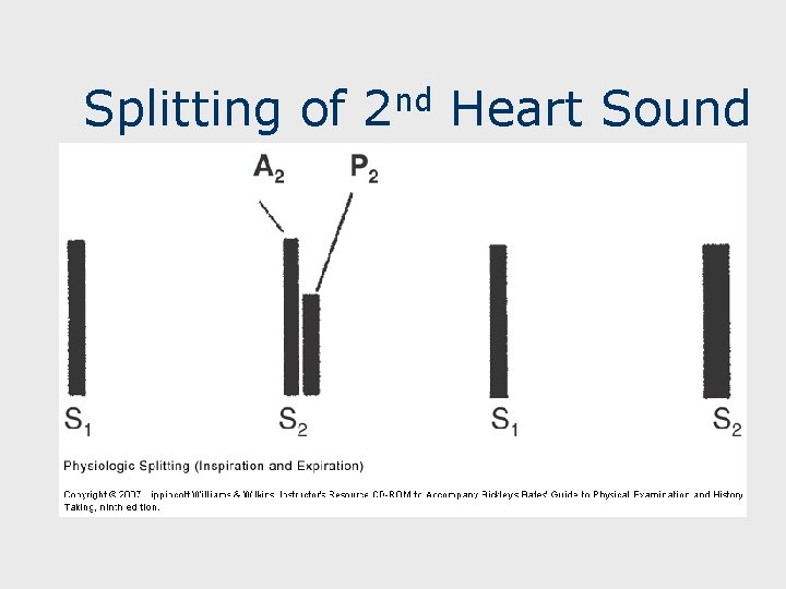 Splitting of 2 nd Heart Sound 