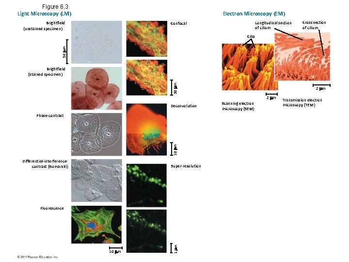 Figure 6. 3 Light Microscopy (LM) Electron Microscopy (EM) Brightfield (unstained specimen) Longitudinal section